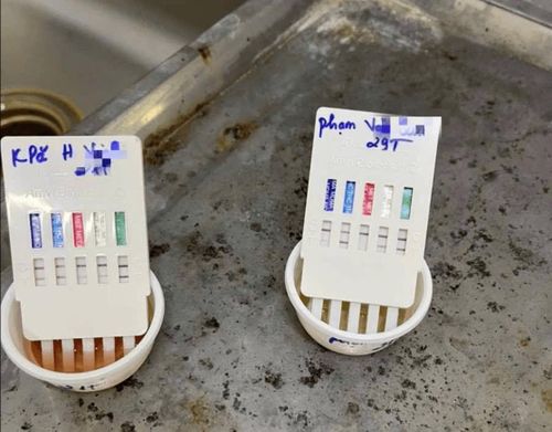 CSGT Công an tỉnh Đắk Lắk test ma túy đối với các tài xế
