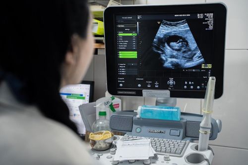  Đây là lần thứ hai chị thực hiện hành trình IVF tại Bệnh viện Bưu Điện. Bốn năm trước, sau nhiều năm mong con, hai vợ chồng đến khám và được xác định nguyên nhân vô sinh từ người chồng không có tinh trùng. Dù đã trải qua phẫu thuật tìm tinh trùng nhưng không đạt kết quả như mong muốn, gia đình quyết định xin tinh trùng từ ngân hàng tinh trùng để thực hiện IVF và may mắn đón con đầu lòng. 
