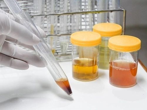  Nước tiểu là sản phẩm được tạo ra sau quá trình lọc máu của thận, vì vậy đây cũng là một trong những "tín hiệu" phản ánh trực tiếp sức khỏe của cơ quan này. Ảnh: Shutterstock. 