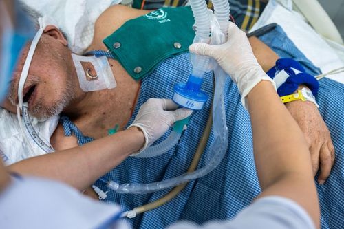  Một bệnh nhân đột quỵ cấp cứu tại Bệnh viện Bạch Mai (Hà Nội). Ảnh: Đinh Hà. 