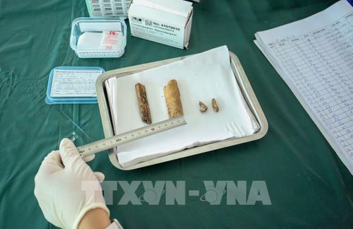 Từng mẫu xương được nhân viên y tế quan sát, lựa chọn cẩn trọng nhằm bảo đảm chất lượng phục vụ giám định ADN. Ảnh: Giang Phương – TTXVN