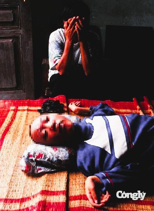 Một người mẹ già bên đứa con nhiễm chất độc da cam.