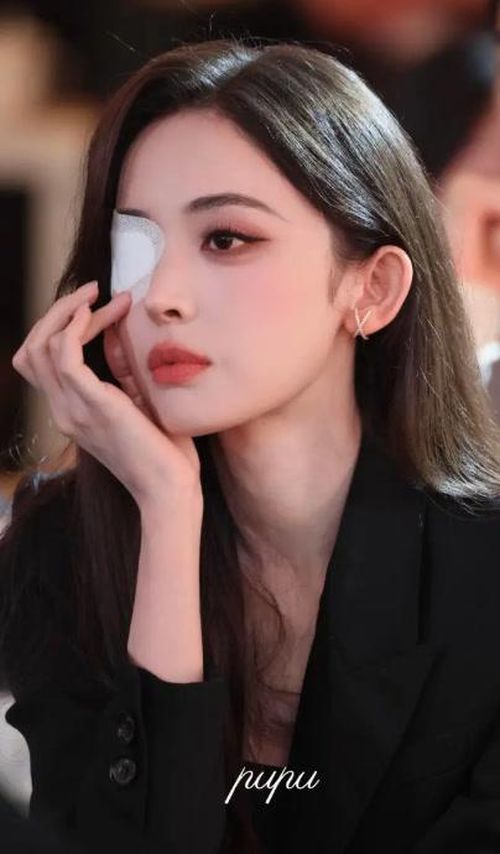 Cổ Lực Na Trát đang cân nhắc thêm các phương pháp điều trị, trong khi phẫu thuật mới chỉ là phương án nếu tình trạng không cải thiện. Ảnh: Weibo.
