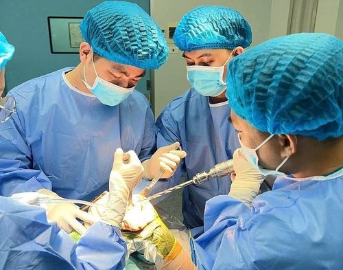 Các bác sĩ BVĐK TTH Hà Tĩnh áp dụng kỹ thuật Subvastus để thay khớp gối cho bệnh nhân. Ảnh: BVCC