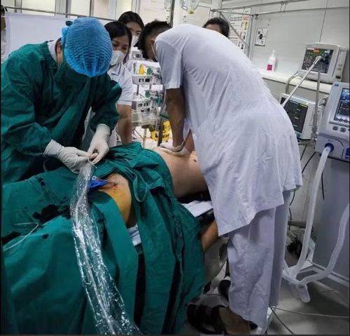 Thiết lập hệ thống ECMO để cứu bệnh nhân - Ảnh BVCC