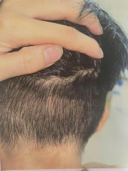Bé trai 8 tuổi được cho là có nhiều vết bầm tím, xây xát trên cơ thể sau khi ở với cha.