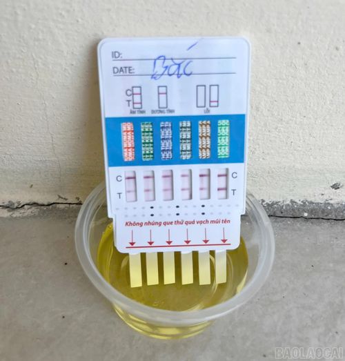 Quá trình thực hiện được tổ chức theo từng bộ phận, đơn vị, bảo đảm trật tự, khoa học và không ảnh hưởng đến hoạt động chuyên môn.