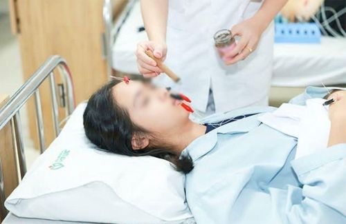 Nữ sinh được điều trị méo miệng, lệch mặt
