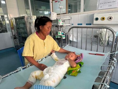 Hiện tại để chăm sóc Nhân ở viện, anh Vừ cùng mẹ phải thay nhau túc trực