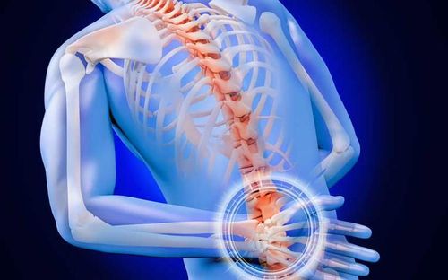 Viêm cột sống dính khớp là bệnh viêm hệ thống mạn tính, với tổn thương chủ yếu ở khớp cùng chậu, cột sống và các khớp trục. Ảnh AI