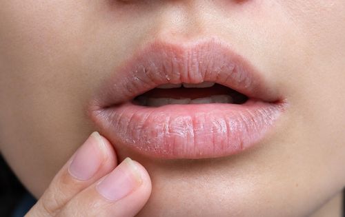 Khô miệng gây nhiều phiền toái trong đời sống có thể là do nhiều nguyên nhân gây ra. Ảnh: Magnific.