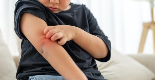 Trẻ có dấu hiệu ngứa khi bị nhiễm giun sán. Ảnh: Shutterstock.