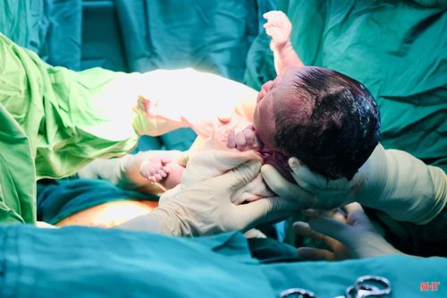 Lúc 11h cùng ngày, Bộ phận Sản yêu cầu - Khoa Sản, BVĐK tỉnh Hà Tĩnh đã mổ lấy thai thành công cho sản phụ Nguyễn Thị Dương (xã Thạch Lạc).