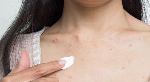 Ngành công nghiệp chăm sóc da chống ô nhiễm là một thị trường có giá trị lên tới hàng tỷ USD. Ảnh: The London Dermatology Centre