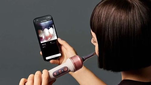 Đương nhiên camera này còn có thể dùng để theo dõi chi tiết trong khoang miệng.