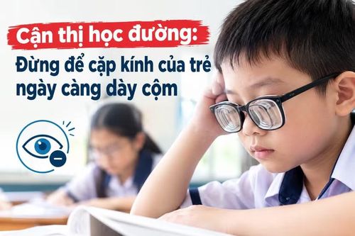Đừng để trẻ lớn lên cùng cặp kính ngày càng dày.