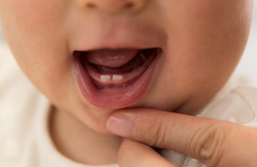 Cha mẹ nên chú ý chăm sóc răng miệng cho trẻ từ sớm để bảo vệ hàm răng vĩnh viễn của con trong tương lai. Ảnh: Shutterstock.