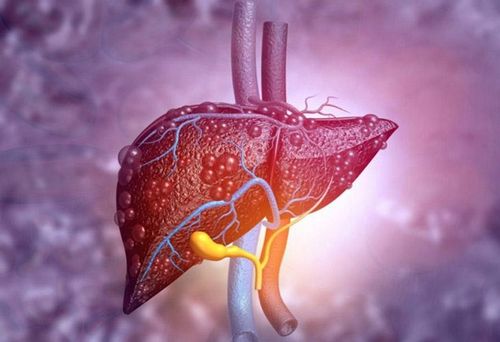 Viêm gan có thể diễn biến âm thầm, đặc biệt ở người mắc viêm gan virus mạn tính. Ảnh AI.