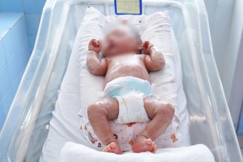  Lớp da toàn cơ thể của trẻ căng bóng, khô, bong vảy như vảy cá. 