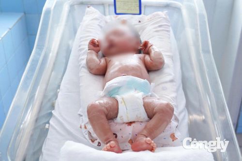 Bé sinh non mắc vảy cá hiếm gặp được các bác sĩ điều trị thành công.