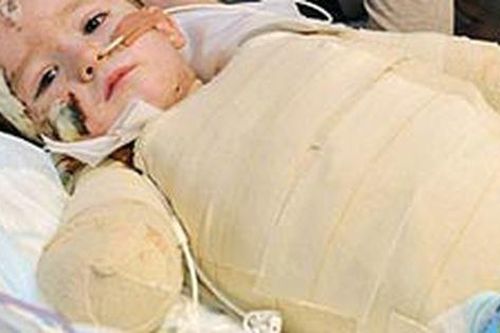 Bé trai can đảm nhất nước Anh