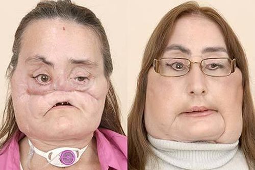 Phép lạ từ những ca phẫu thuật đại tài