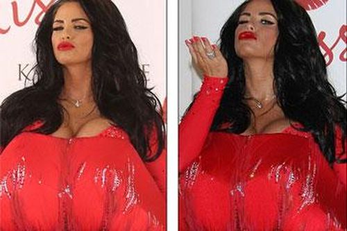 'Siêu mẫu ngực bự' Katie Price to cồng kềnh như thùng phi