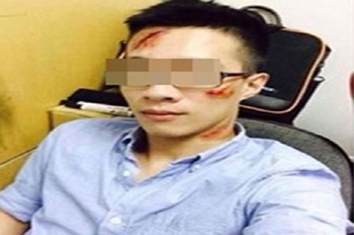 Trai trẻ hứng 'gạch đá' vì đăng ảnh vết chém trên mặt