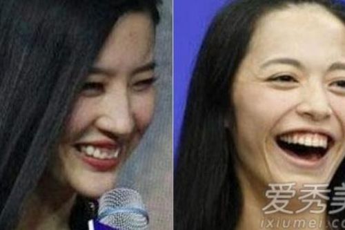 Những mỹ nhân Hoa ngữ mất điểm vì cười hở lợi