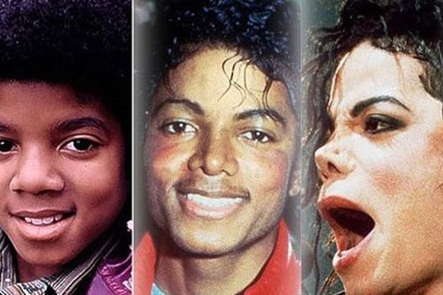 Hành trình 25 năm 'dao kéo' của vua pop Michael Jackson