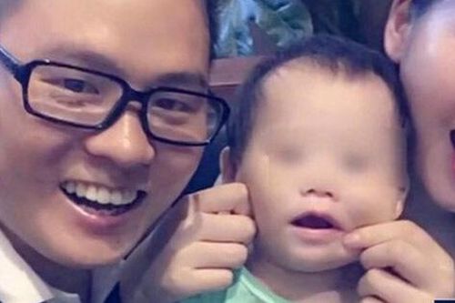 Bé nguy kịch vì mẹ bất cẩn khi sử dụng vòi hoa sen