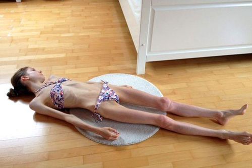 Phép màu tình yêu khiến cô gái nặng 22kg thay đổi hoàn toàn
