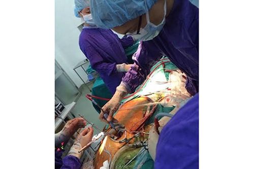 Phẫu thuật tim hở ít xâm lấn