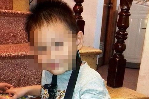 Bệnh viện Nhi đồng 2 chẩn đoán bé gãy tay 3 lần đều sai