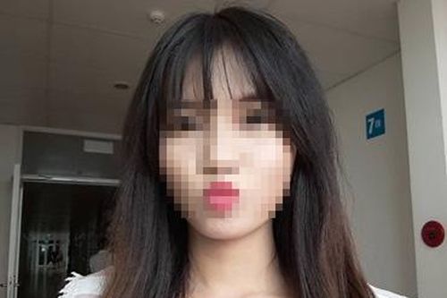 Cô gái xinh đẹp bị bỏng toàn thân, mặt biến dạng sau tai nạn