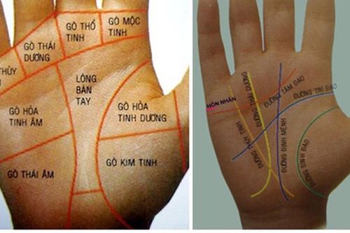 Nốt ruồi ở vị trí nào trên bàn tay là đại phú quý?