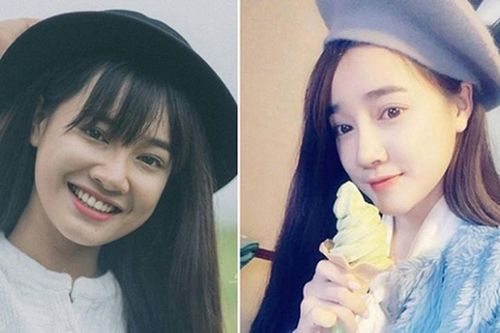 Mũi cao, cằm nhọn, Nhã Phương dính nghi án 'dao kéo'