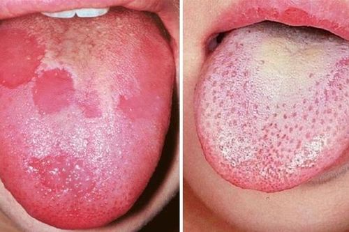 10 dấu hiệu cảnh báo bạn có thể đã mắc ung thư giai đoạn đầu