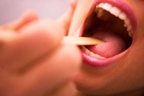 Nếu cắt amidan bạn nhất định phải biết những điều này