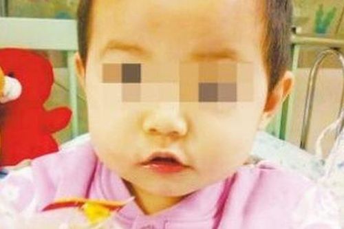 Bé gái 2 tuổi suýt mất mạng vì nghịch đũa khi đang ăn cơm