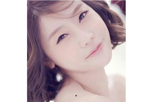 7 vị trí nốt ruồi trên vai phụ nữ nói lên điều gì?