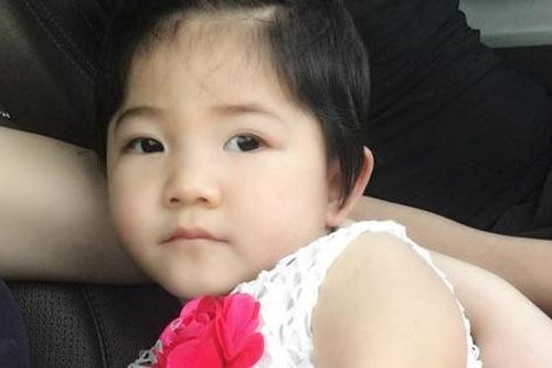 Hình ảnh xinh như công chúa của bé gái Sapa suy dinh dưỡng sau 10 tháng được nhận nuôi