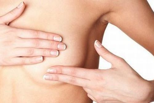 Chưa lấy chồng nhưng liên tục tiết sữa là bệnh gì?