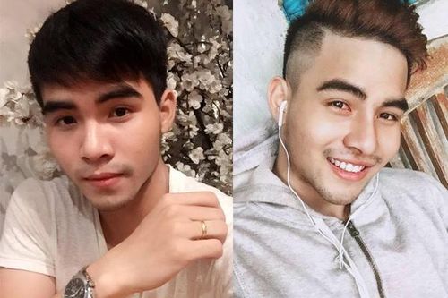 Chàng trai một năm sửa mũi 4 lần để sở hữu khuôn mặt lai tây
