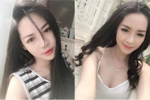 Hot girl Nam Định ước tính 'xây lại mặt' hết 1,5 tỷ