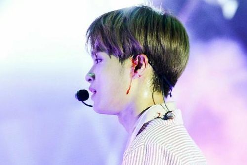 Thành viên Wanna One chấn thương, netizen phẫn nộ khi quản lí bắt ở lại chụp ảnh