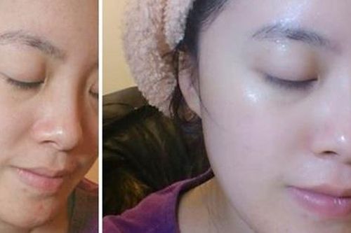 Ai cũng hỏi tôi đi spa 1 tuần mấy lần, nhưng thực ra tôi chỉ đắp mặt nạ chuối thôi