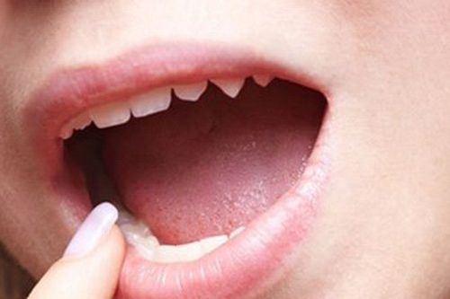 Lè lưỡi soi gương, nhìn màu lưỡi biết ngay bệnh cơ thể