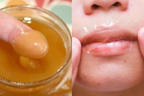 Môi khô nẻ, nứt toác cỡ nào chỉ cần bôi thứ này sẽ mềm mại, căng mọng chỉ sau 1 đêm