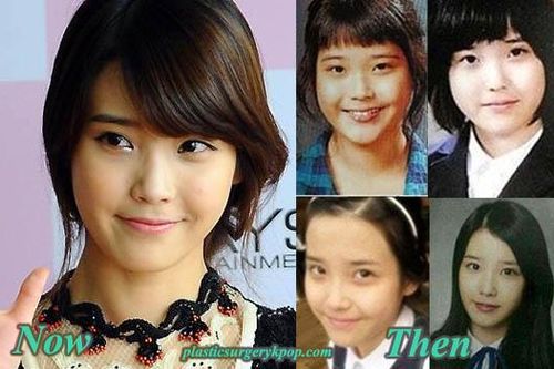 Vừa gây sốt trong Người tình ánh trăng, IU đã bị tố thẩm mỹ